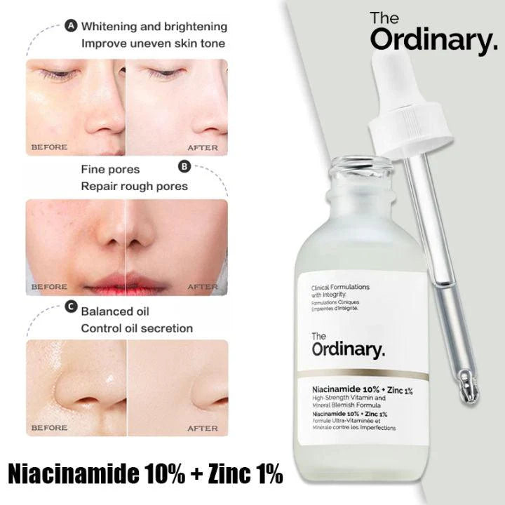 The Ordinary - Niacinamide 10% & Zinc 1% Serum